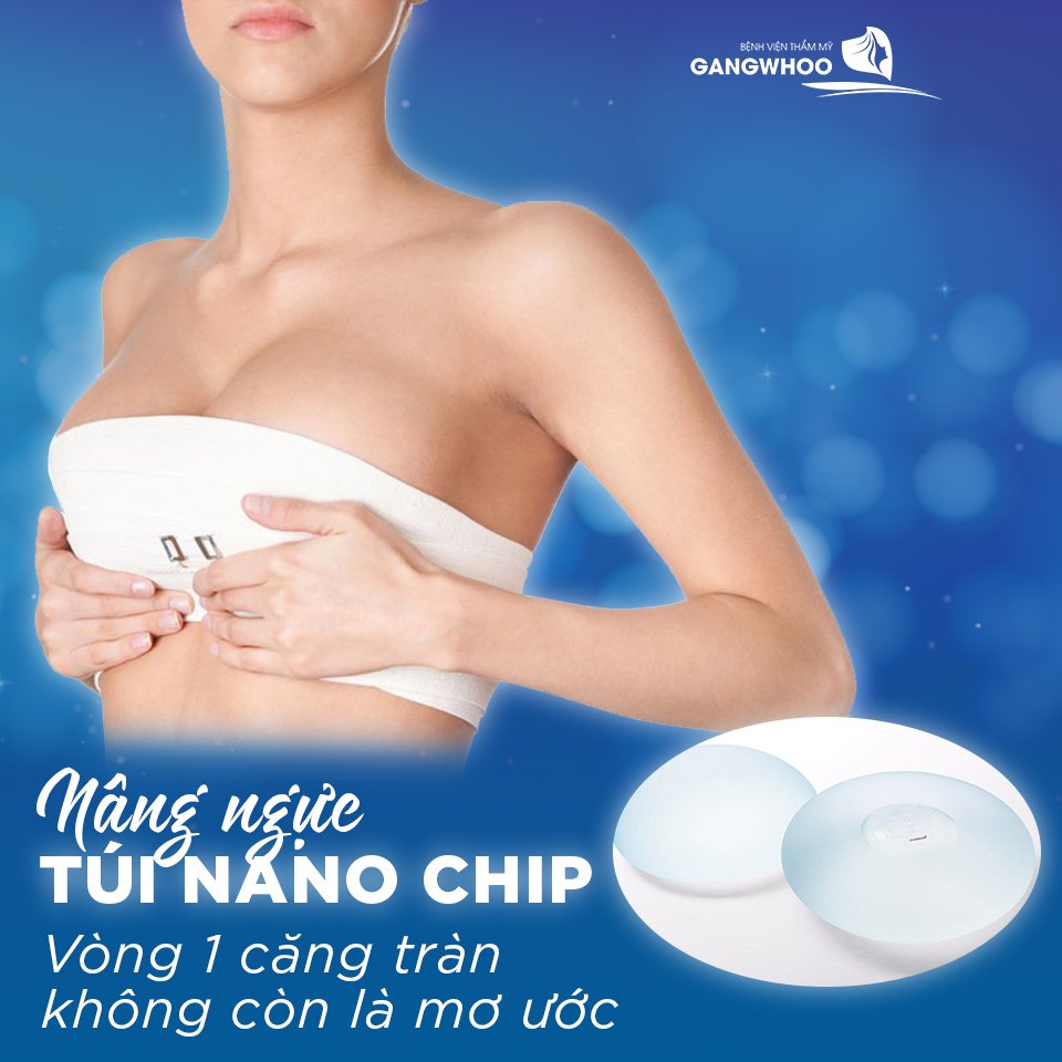 Nâng ngực nội soi túi Nano Chip giúp vòng 1 căng tròn