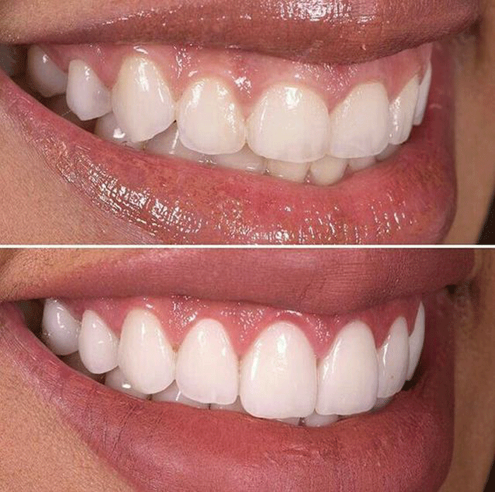 hàm răng sạch và khỏe