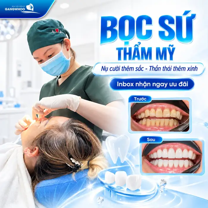 Bọc Răng Sứ Rạng Rỡ Khoe Nụ Cười Xinh, Tự Tin Mọi Ánh Nhìn