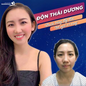 Don thai duong