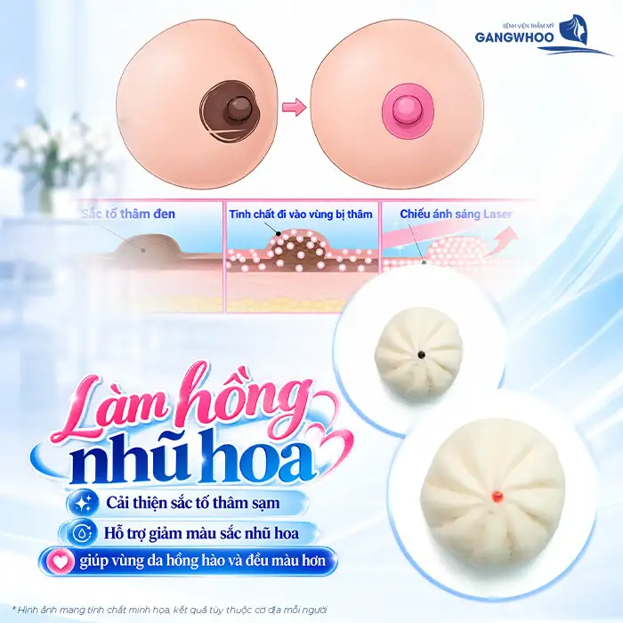 Làm hồng nhũ hoa giúp cải thiện sắc tố, tăng vẻ tươi tắn cho “Núi Đôi”