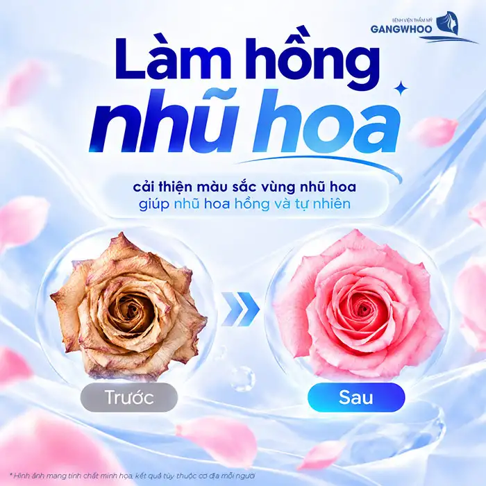 Làm hồng nhũ hoa giúp cải thiện sắc tố, tăng vẻ tươi tắn cho “Núi Đôi”