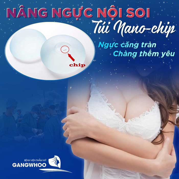 Nâng ngực nội soi túi Nano Chip bệnh viện Gangwhoo