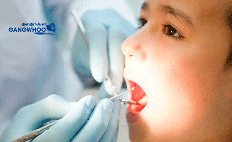 lợi ích nhổ răng