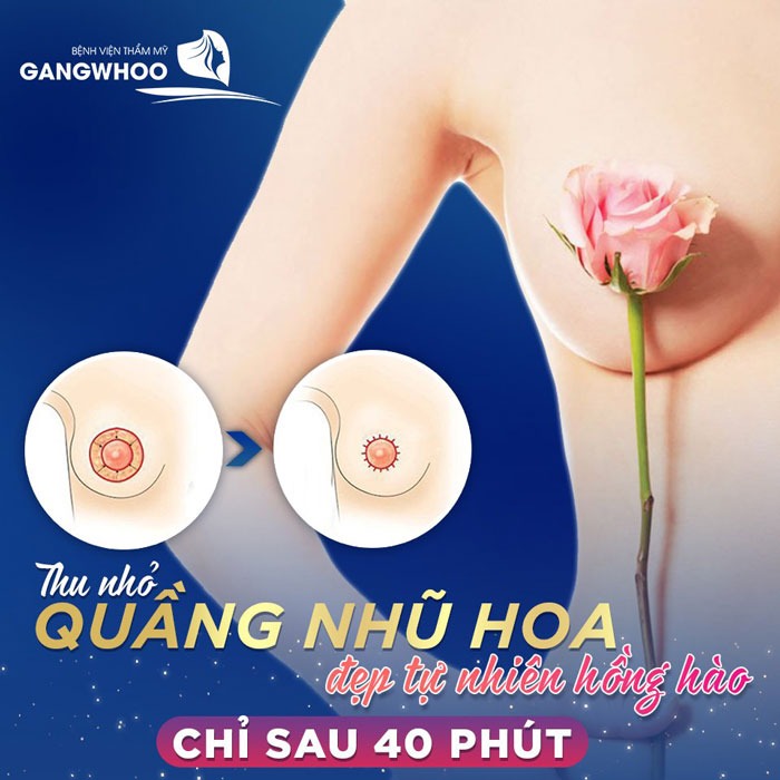 Thu nhỏ quầng vú đẹp tự nhiên chỉ sau 40 phút tại bệnh viện Gangwhoo
