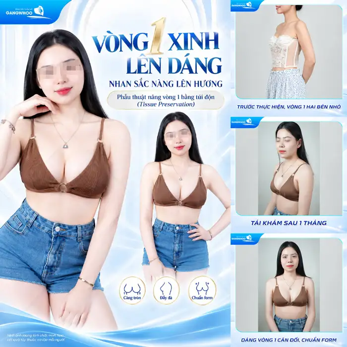 Nâng Ngực Ergonomix – Giúp Vòng 1 Căng Tròn, Đầy Đặn