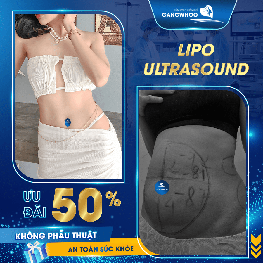 Lipo Ultrasound không phẫu thuật, an toàn sức khỏe