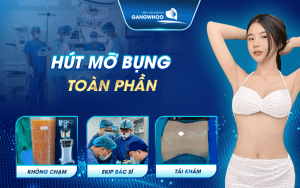 hut mo bung toan phan