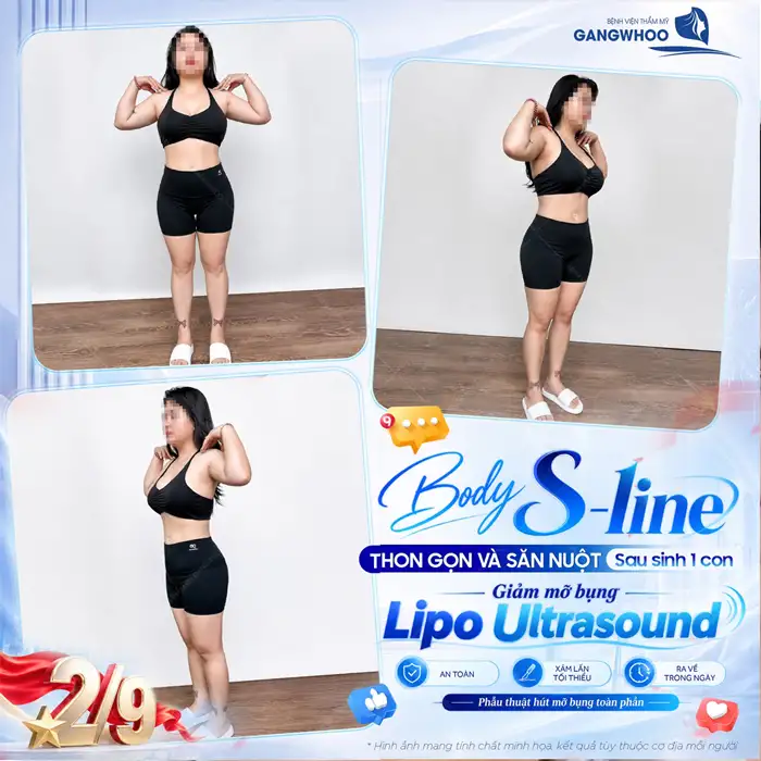 Giảm Béo Lipo Ultrasound