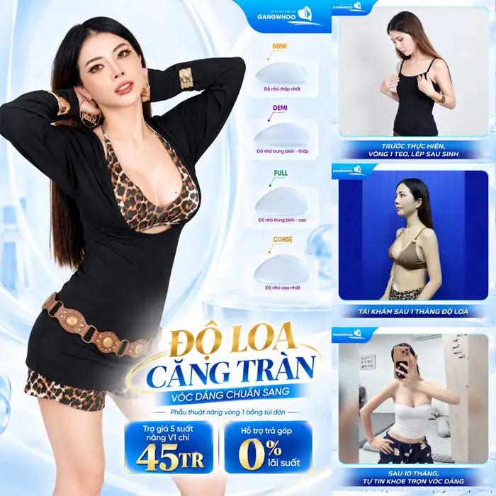 Nâng Ngực Túi Arion Vi Nhám – Chuẩn Hàn Tại Việt Nam