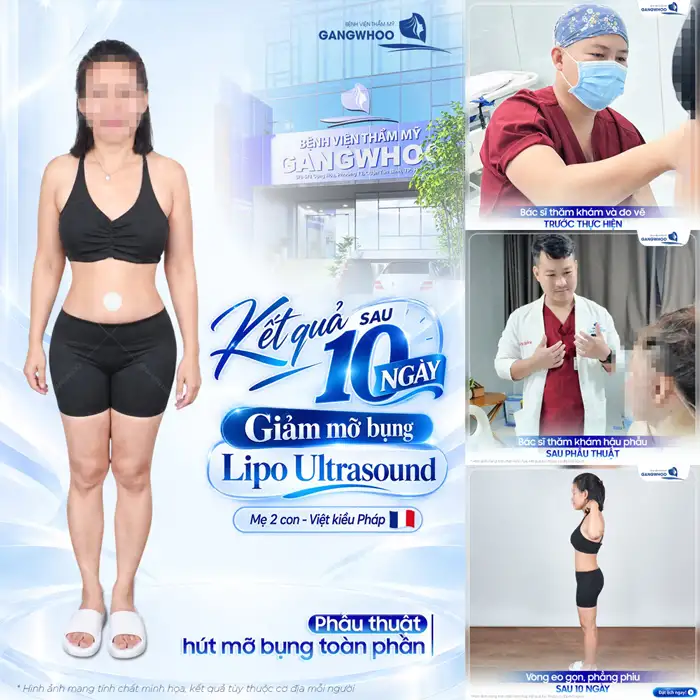 Giảm Béo Lipo Ultrasound