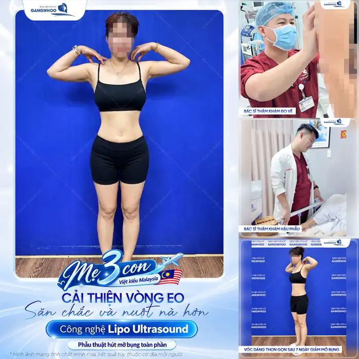 Giảm Béo Lipo Ultrasound