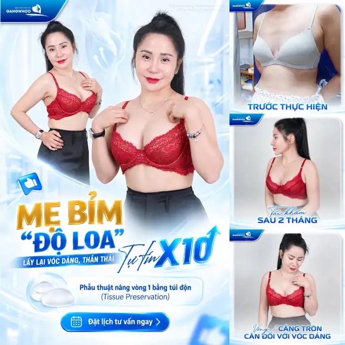 Nâng Ngực Túi Arion Vi Nhám – Chuẩn Hàn Tại Việt Nam
