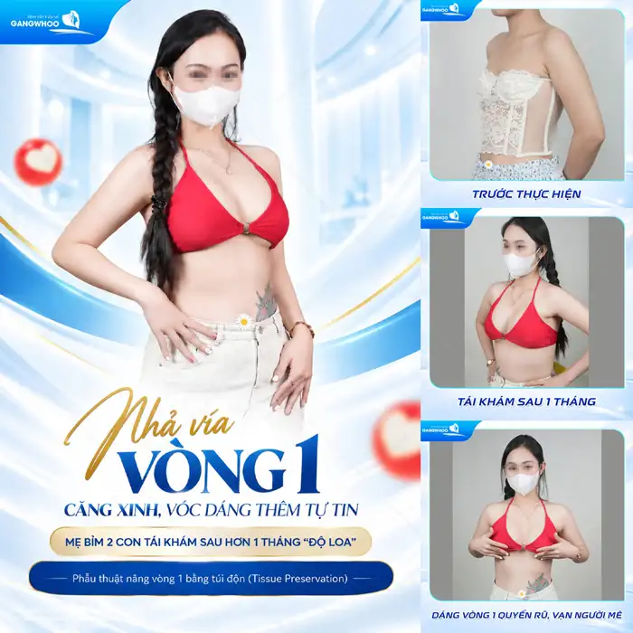 Nâng Ngực Túi Arion Vi Nhám – Chuẩn Hàn Tại Việt Nam
