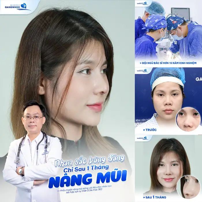Nâng Mũi Perfect – Giải Pháp Cho Dáng Mũi