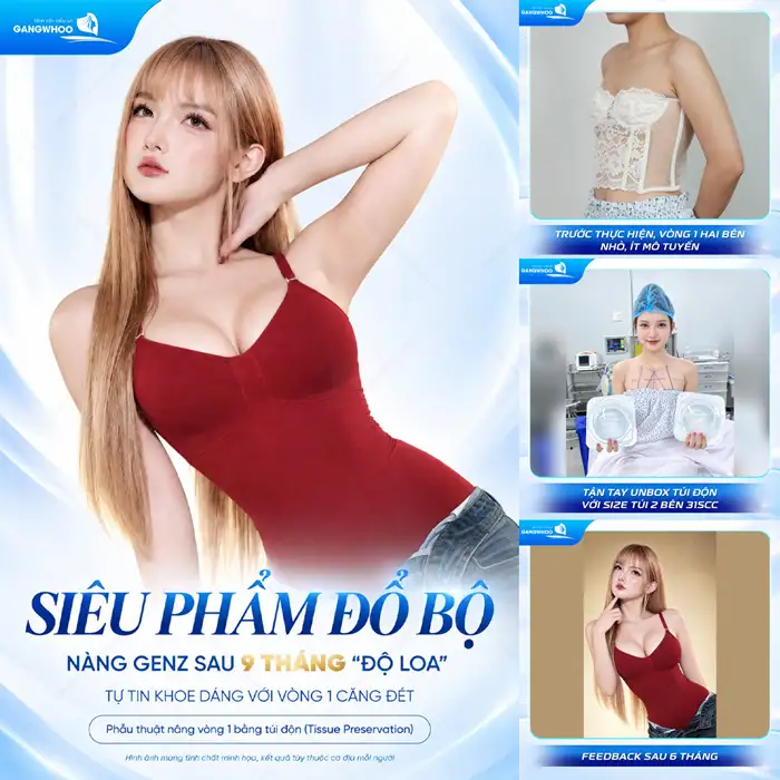 Nâng Ngực Túi Arion Vi Nhám – Chuẩn Hàn Tại Việt Nam