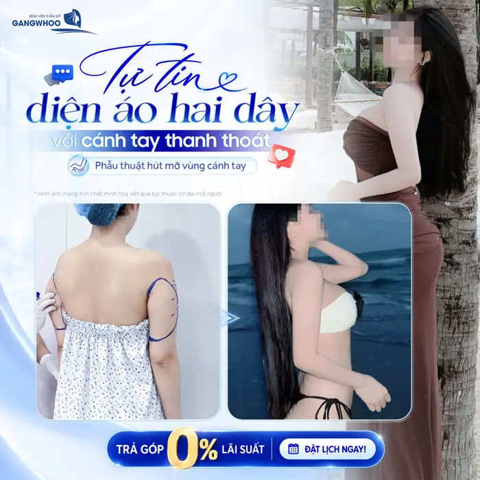 Tự tin diện áo 2 dây với cánh tay thanh thoát