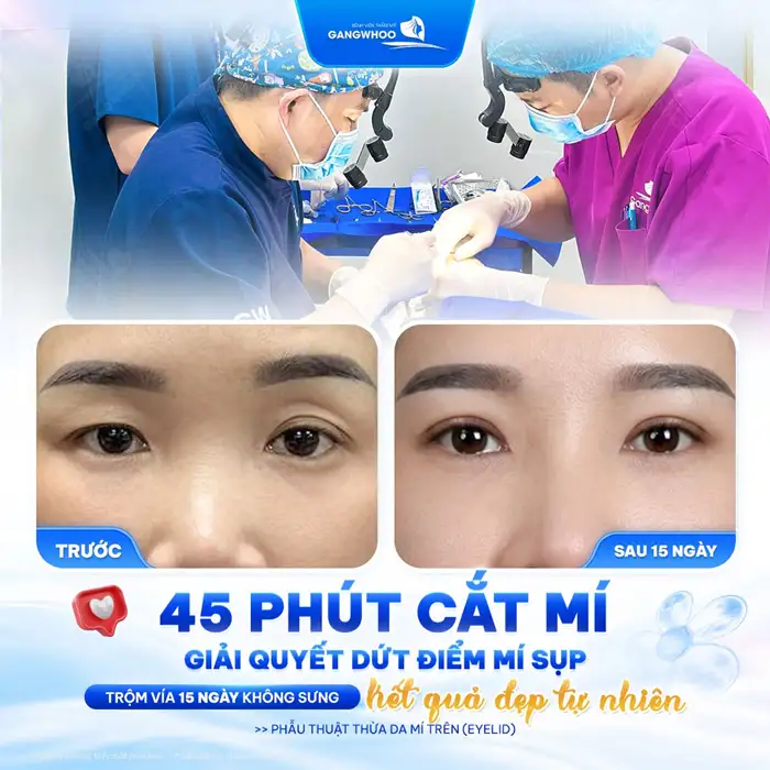 CẮT MÍ HÀN QUỐC ĐẸP CHUẨN “SAO HÀN” XU THẾ MÍ MẮT MỚI 2024