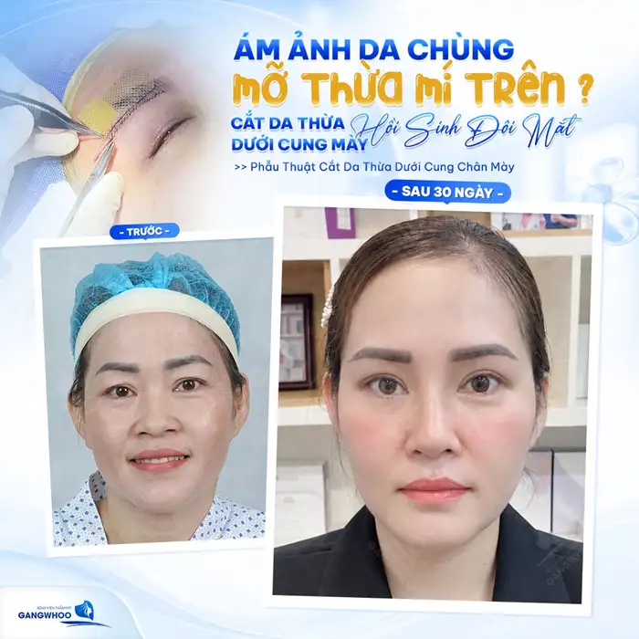 NÂNG CUNG CHÂN MÀY – GIỮA MÃI THANH XUÂN