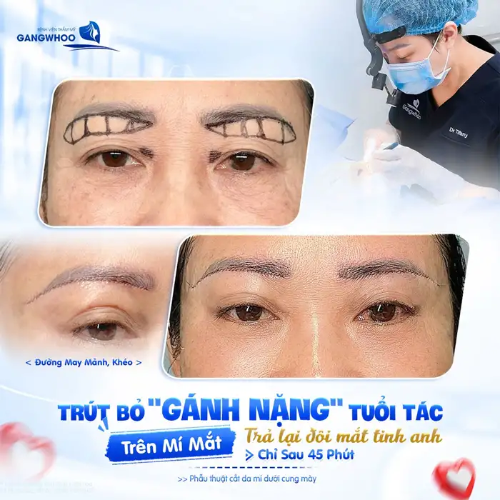 NÂNG CUNG CHÂN MÀY – GIỮA MÃI THANH XUÂN