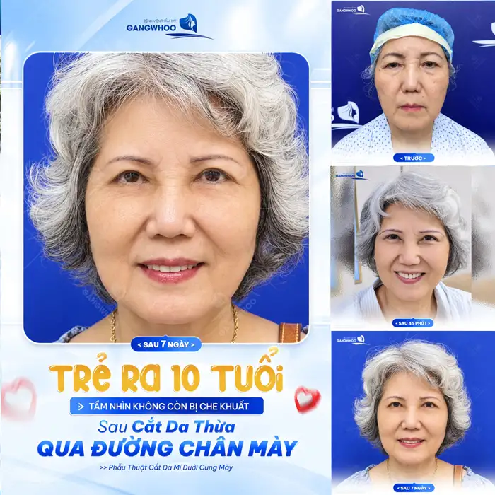 NÂNG CUNG CHÂN MÀY – GIỮA MÃI THANH XUÂN