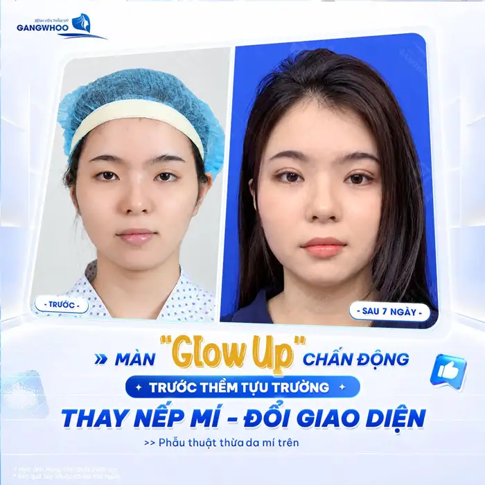 CẮT MÍ HÀN QUỐC ĐẸP CHUẨN “SAO HÀN” XU THẾ MÍ MẮT MỚI 2024