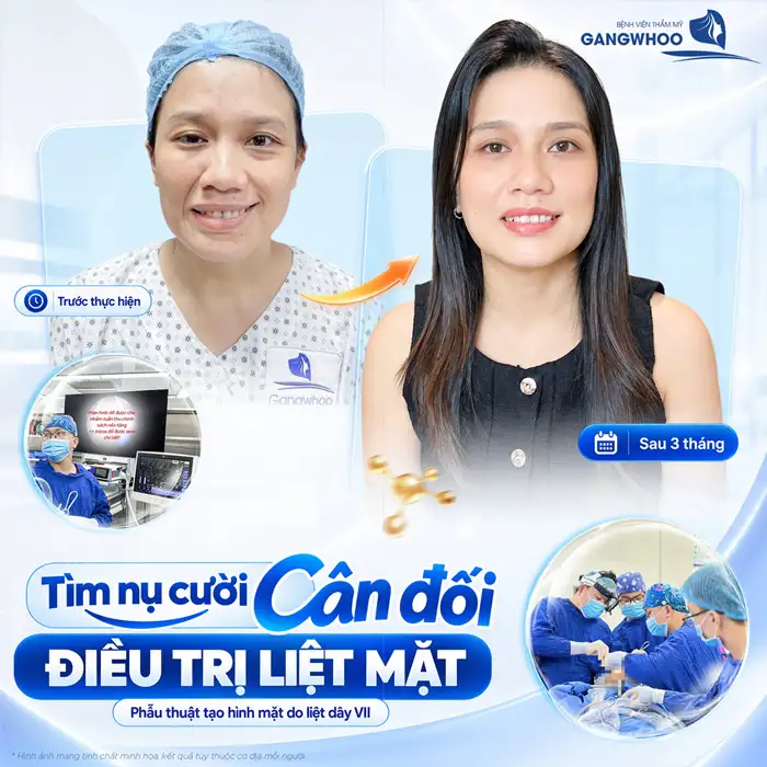 Điều trị liệt mặt (dây thần kinh số 7): Chẩn đoán và điều trị