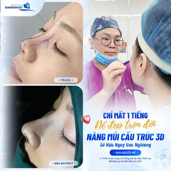 TOP 6 BÁC SĨ NÂNG MŨI ĐẸP Ở TPHCM