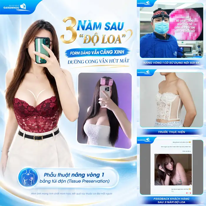 Nâng Ngực Sau Bao Lâu Thì Mềm Và Đẹp Tự Nhiên