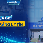 Địa chỉ niềng răng uy tín TPHCM