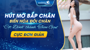 Hút mỡ bắp chân biến hóa đôi chân