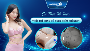 Sự Thật Về Việc “Hút Mỡ Bụng Có Nguy Hiểm Không?”