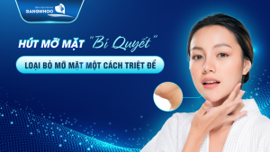 Hút mỡ mặt bí quyết loại bỏ mỡ mặt một cách triệt để