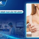 Sau khi nâng ngực bao lâu thì lành
