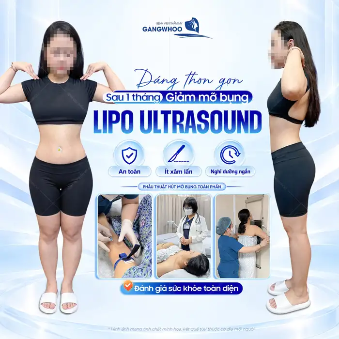 Hút Mỡ Bụng Ở Đâu An Toàn Không Lo Xảy Ra Biến Chứng Nguy Hiểm