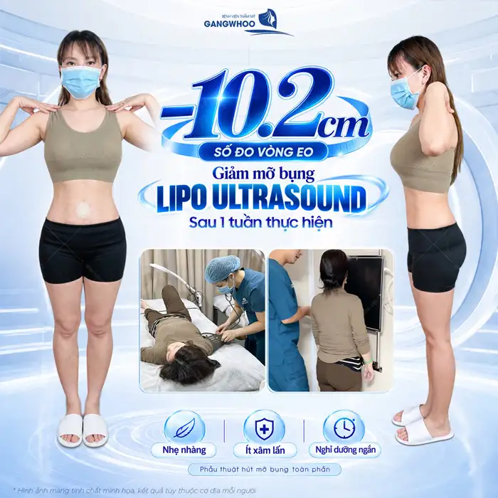 Công Nghệ Hút Mỡ Bụng Chuẩn Hàn Thoát Vòng Eo “Bánh Mì”