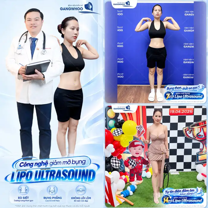 Liệu Bạn Đã Biết Hút Mỡ Bụng Ở Đâu An Toàn Tại TPHCM Chưa?