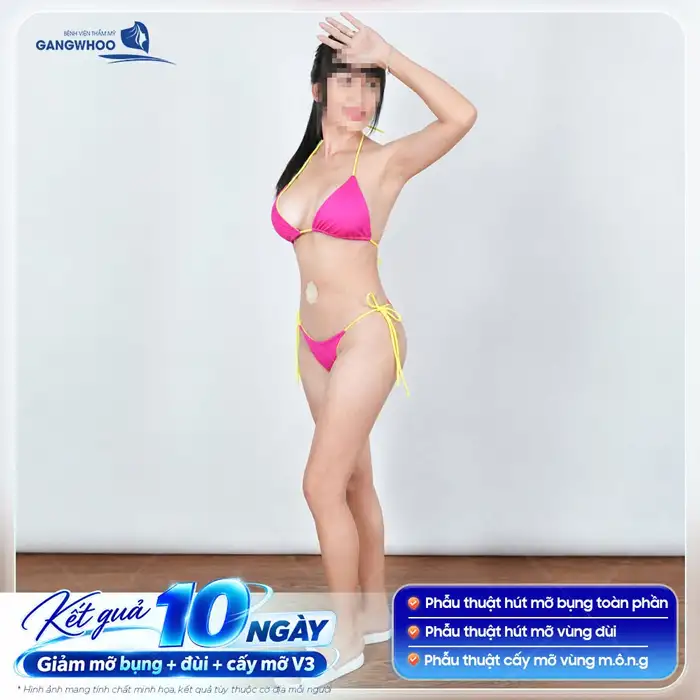 Chăm Sóc Sau Hút Mỡ Bụng Như Thế Nào Cho Hiệu Quả?