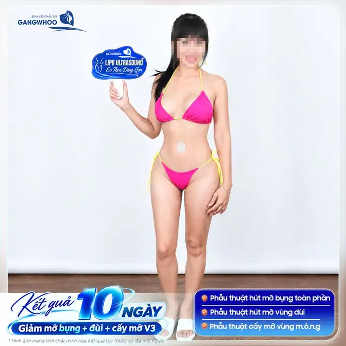 Chăm Sóc Sau Hút Mỡ Bụng Như Thế Nào Cho Hiệu Quả?