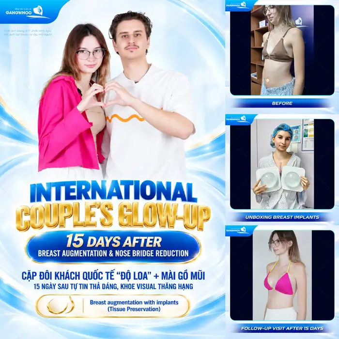 Nâng ngực bao lâu thì lành? Nên làm gì trong giai đoạn hồi phục?
