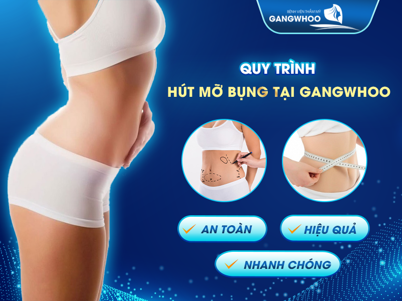 Quy trình hút mỡ bụng tại bệnh viện Gangwhoo