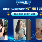 Khách Hàng Review Hút Mỡ Bụng Chân Thực Chi Tiết -
