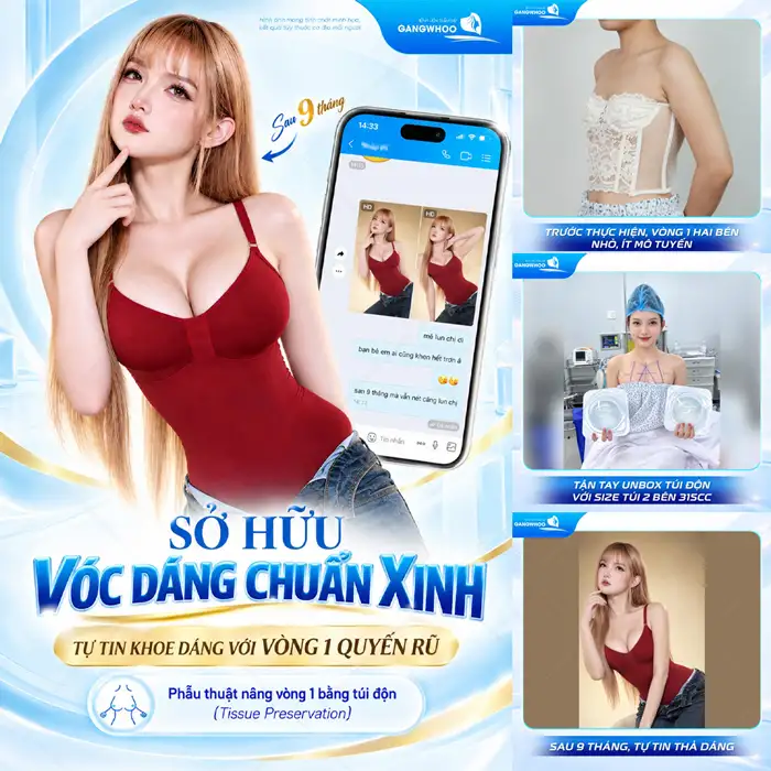Nâng ngực đường nào tốt hiện nay?