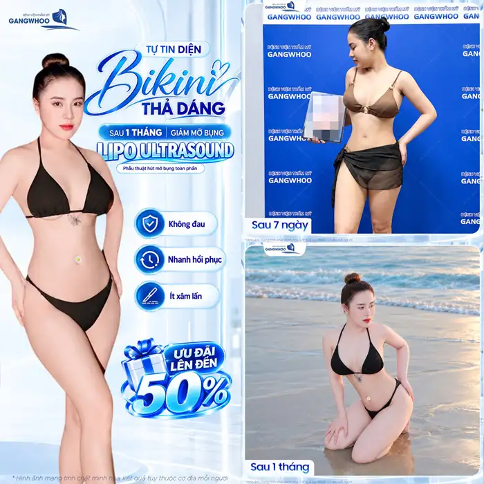 Công Nghệ Hút Mỡ Bụng Chuẩn Hàn Thoát Vòng Eo “Bánh Mì”