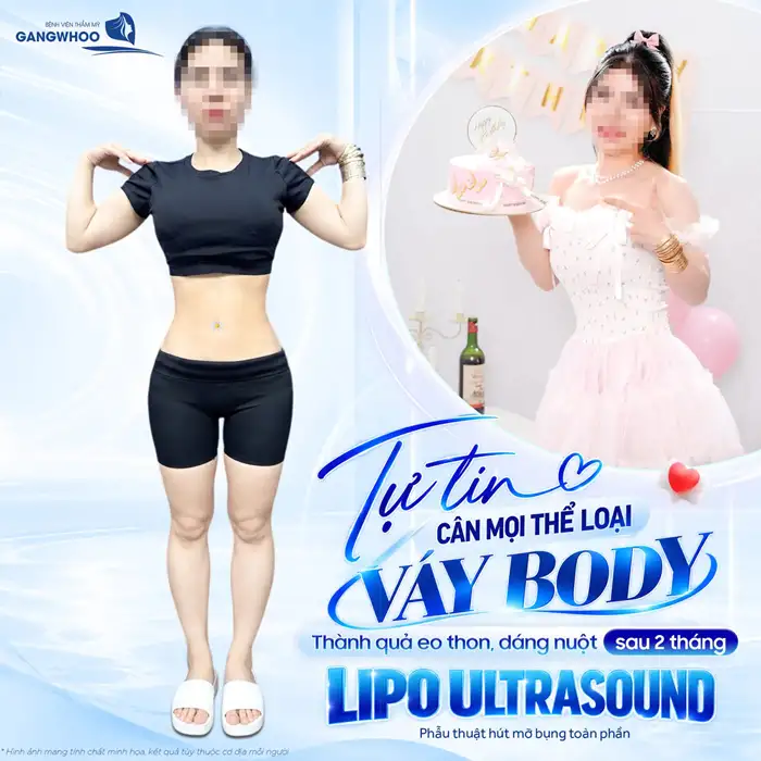 Phương Pháp “Hút Mỡ Như Thế Nào” Bạn Đã Biết Chưa?