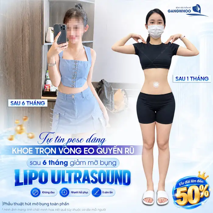Phương Pháp “Hút Mỡ Như Thế Nào” Bạn Đã Biết Chưa?
