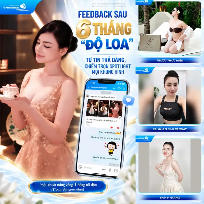 Quy trình nâng ngực – Bệnh viện Thẩm mỹ GANGWHOO