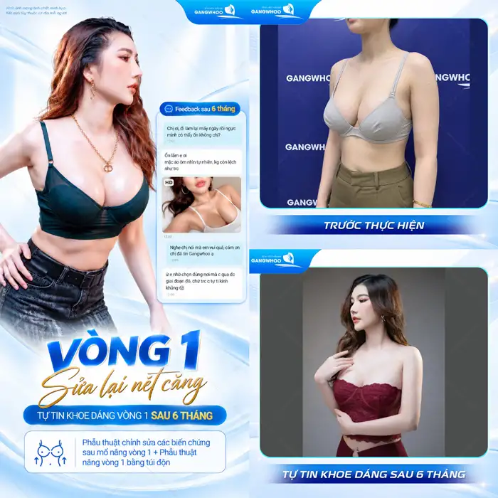 NÂNG NGỰC SAU BAO LÂU THÌ HẾT ĐAU – 5 CÁCH GIẢM ĐAU HIỆU QUẢ