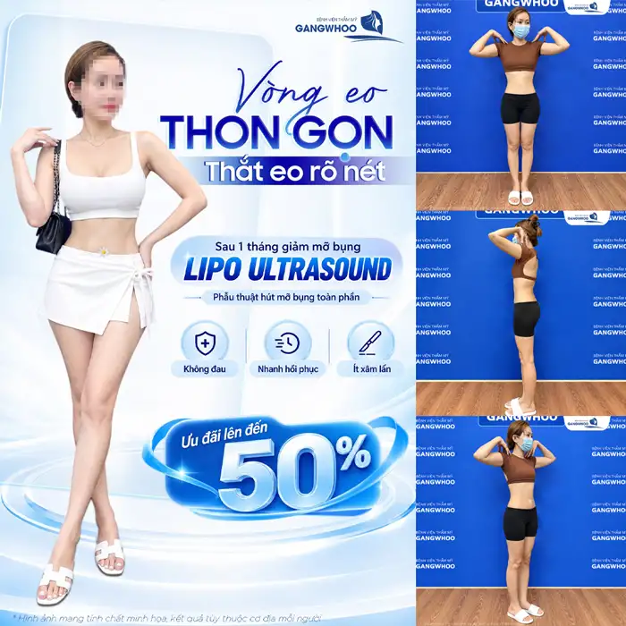 Nên Tiêm Tan Mỡ Hay Hút Mỡ Lựa Chọn Nào Tốt Hơn?