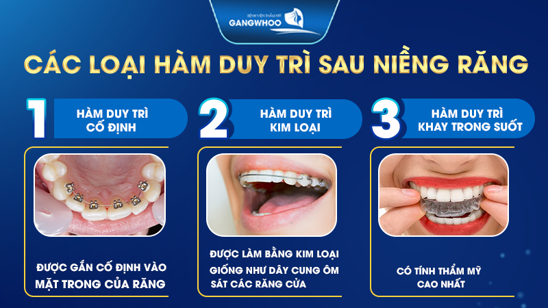 Các loại hàm duy trì sau niềng răng